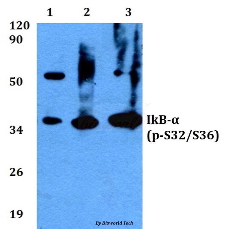 Anti-IkB-α (phospho-S32/S36) Antibody from Bioworld Technology (BS4105) - Antibodies.com