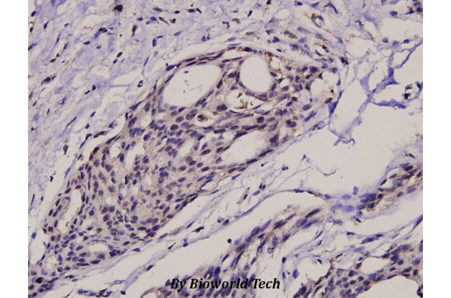 Anti-IkB-α (phospho-S32/S36) Antibody from Bioworld Technology (BS4105) - Antibodies.com