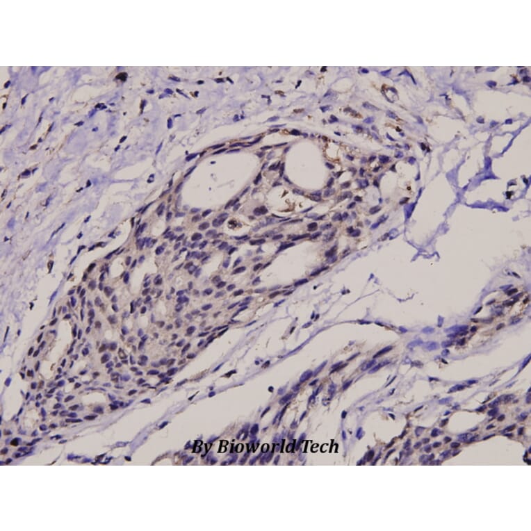 Anti-IkB-α (phospho-S32/S36) Antibody from Bioworld Technology (BS4105) - Antibodies.com
