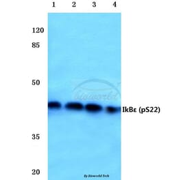 Anti-IkB-ε (phospho-S22) Antibody from Bioworld Technology (BS4107) - Antibodies.com