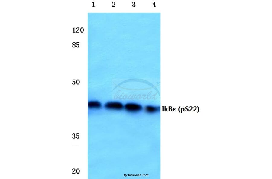 Anti-IkB-ε (phospho-S22) Antibody from Bioworld Technology (BS4107) - Antibodies.com