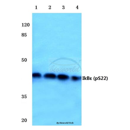 Anti-IkB-ε (phospho-S22) Antibody from Bioworld Technology (BS4107) - Antibodies.com