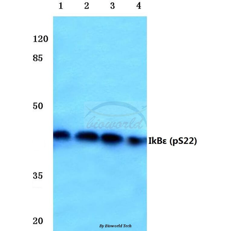 Anti-IkB-ε (phospho-S22) Antibody from Bioworld Technology (BS4107) - Antibodies.com