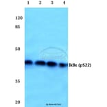 Anti-IkB-ε (phospho-S22) Antibody from Bioworld Technology (BS4107) - Antibodies.com