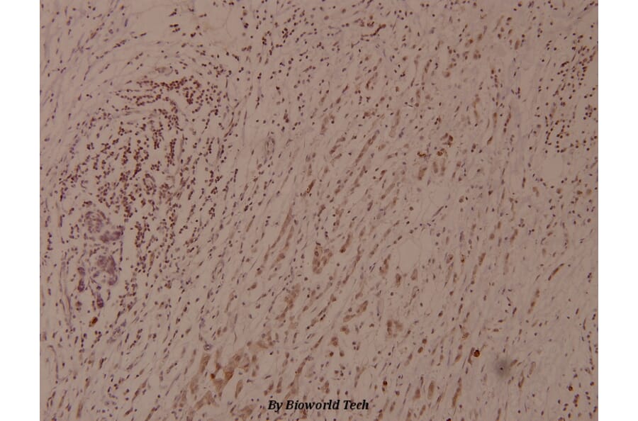 Anti-IkB-ε (phospho-S22) Antibody from Bioworld Technology (BS4107) - Antibodies.com