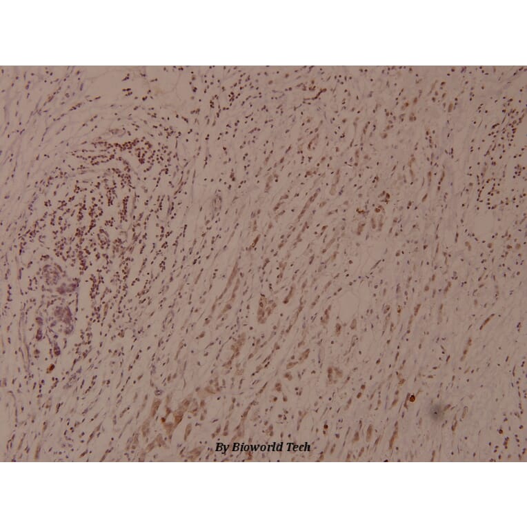 Anti-IkB-ε (phospho-S22) Antibody from Bioworld Technology (BS4107) - Antibodies.com