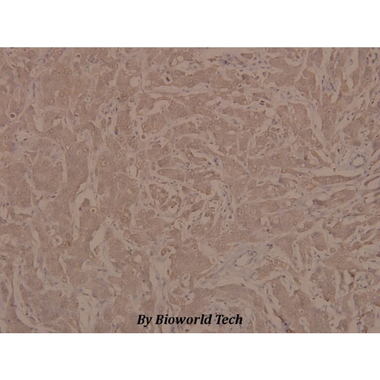 Anti-JAK1 (phospho-Y1022) Antibody from Bioworld Technology (BS4108) - Antibodies.com