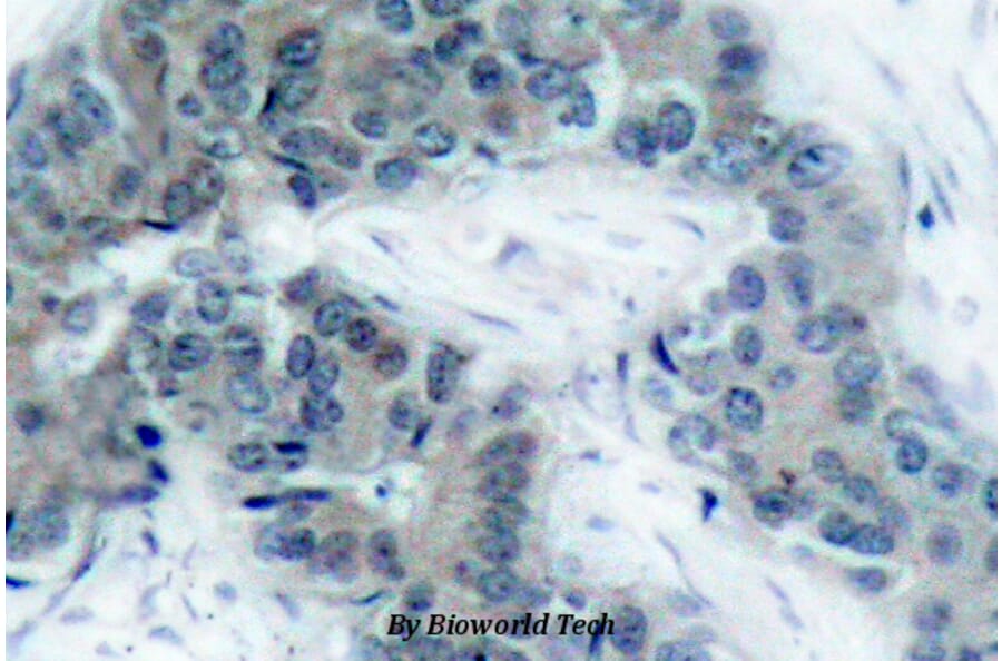 Anti-JAK2 (phospho-Y1007) Antibody from Bioworld Technology (BS4109) - Antibodies.com