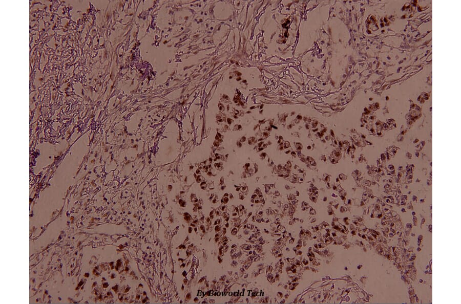Anti-JunB (phospho-S259) Antibody from Bioworld Technology (BS4110) - Antibodies.com