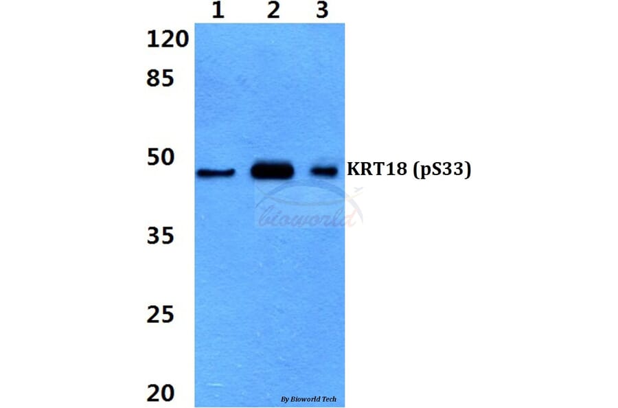 Anti-Cytokeratin 18 Antibody from Bioworld Technology (BS4113) - Antibodies.com