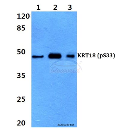 Anti-Cytokeratin 18 Antibody from Bioworld Technology (BS4113) - Antibodies.com