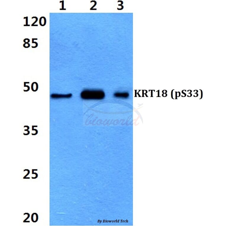 Anti-Cytokeratin 18 Antibody from Bioworld Technology (BS4113) - Antibodies.com
