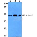 Anti-Cytokeratin 18 Antibody from Bioworld Technology (BS4113) - Antibodies.com
