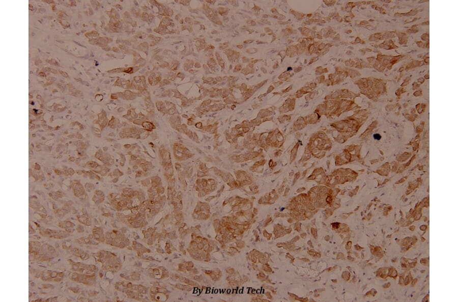 Anti-Cytokeratin 18 Antibody from Bioworld Technology (BS4113) - Antibodies.com