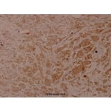 Anti-Cytokeratin 18 Antibody from Bioworld Technology (BS4113) - Antibodies.com