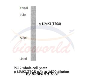 Anti-LIMK1 (phospho-T508) Antibody from Bioworld Technology (BS4115) - Antibodies.com