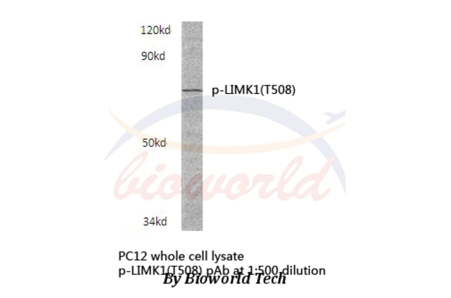 Anti-LIMK1 (phospho-T508) Antibody from Bioworld Technology (BS4115) - Antibodies.com