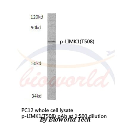 Anti-LIMK1 (phospho-T508) Antibody from Bioworld Technology (BS4115) - Antibodies.com