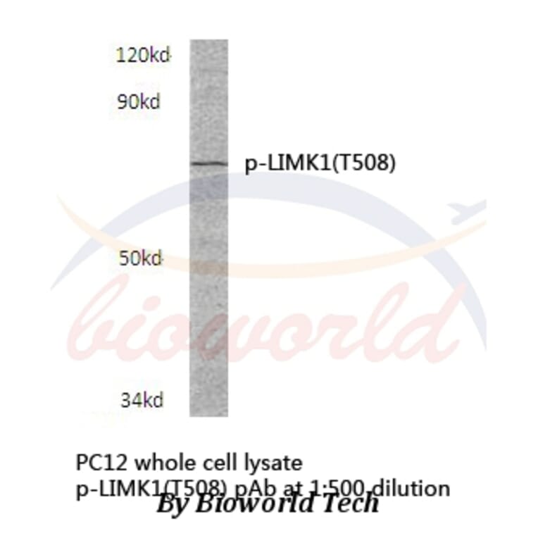 Anti-LIMK1 (phospho-T508) Antibody from Bioworld Technology (BS4115) - Antibodies.com