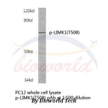 Anti-LIMK1 (phospho-T508) Antibody from Bioworld Technology (BS4115) - Antibodies.com