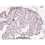 Anti-LIMK1 (phospho-T508) Antibody from Bioworld Technology (BS4115) - Antibodies.com