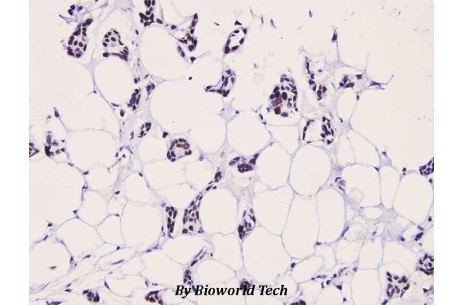 Anti-LIMK2 (phospho-T505) Antibody from Bioworld Technology (BS4117) - Antibodies.com