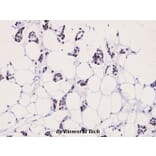 Anti-LIMK2 (phospho-T505) Antibody from Bioworld Technology (BS4117) - Antibodies.com