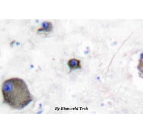 Anti-Lyn (phospho-Y507) Antibody from Bioworld Technology (BS4118) - Antibodies.com