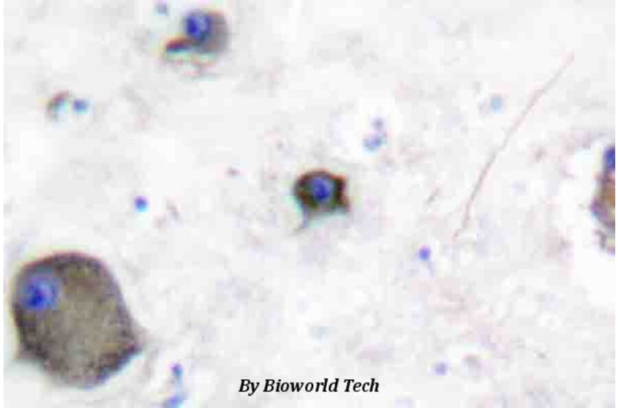 Anti-Lyn (phospho-Y507) Antibody from Bioworld Technology (BS4118) - Antibodies.com