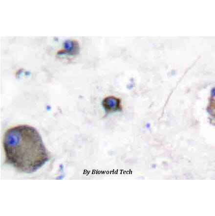 Anti-Lyn (phospho-Y507) Antibody from Bioworld Technology (BS4118) - Antibodies.com