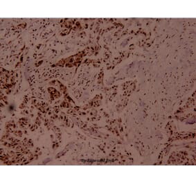 Anti-MEF-2 (phospho-T312) Antibody from Bioworld Technology (BS4120) - Antibodies.com