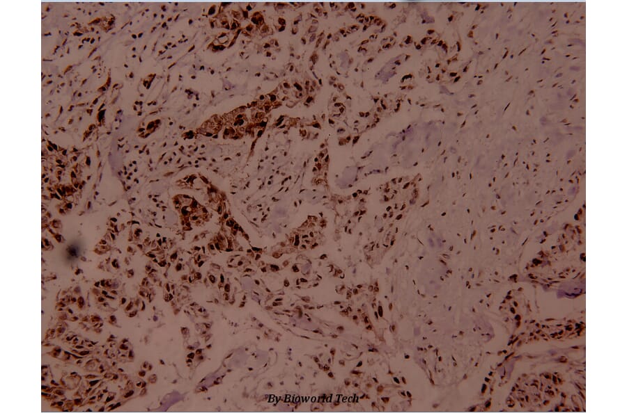 Anti-MEF-2 (phospho-T312) Antibody from Bioworld Technology (BS4120) - Antibodies.com