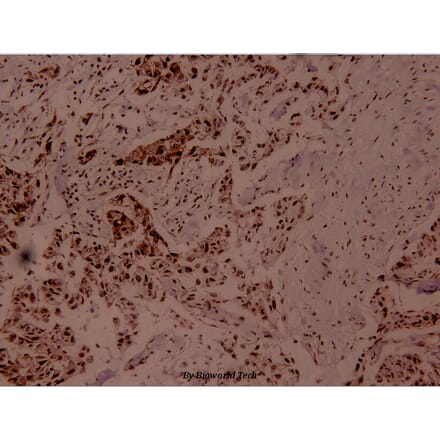 Anti-MEF-2 (phospho-T312) Antibody from Bioworld Technology (BS4120) - Antibodies.com