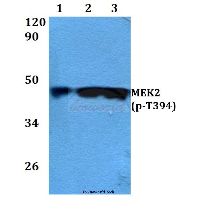 Anti-MEK2 (phospho-T394) Antibody from Bioworld Technology (BS4122) - Antibodies.com