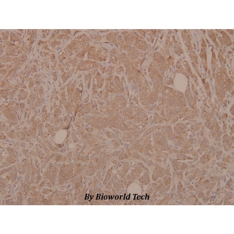 Anti-MEK-3 (phospho-S189) Antibody from Bioworld Technology (BS4123) - Antibodies.com