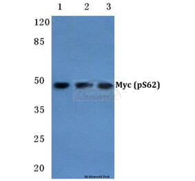Anti-Myc (phospho-S62) Antibody from Bioworld Technology (BS4126) - Antibodies.com