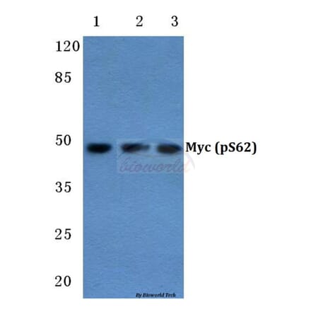 Anti-Myc (phospho-S62) Antibody from Bioworld Technology (BS4126) - Antibodies.com