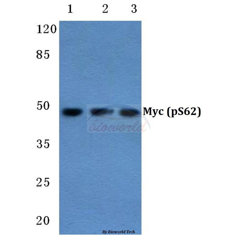 Anti-Myc (phospho-S62) Antibody from Bioworld Technology (BS4126) - Antibodies.com