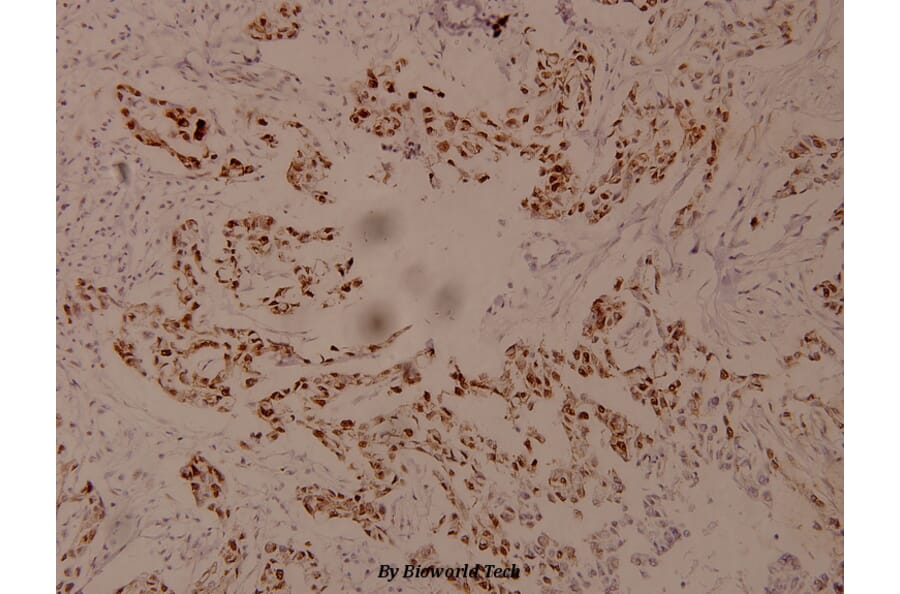 Anti-Myc (phospho-S62) Antibody from Bioworld Technology (BS4126) - Antibodies.com