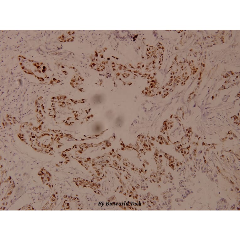 Anti-Myc (phospho-S62) Antibody from Bioworld Technology (BS4126) - Antibodies.com