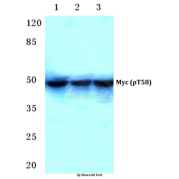 Anti-Myc (phospho-T58) Antibody from Bioworld Technology (BS4128) - Antibodies.com