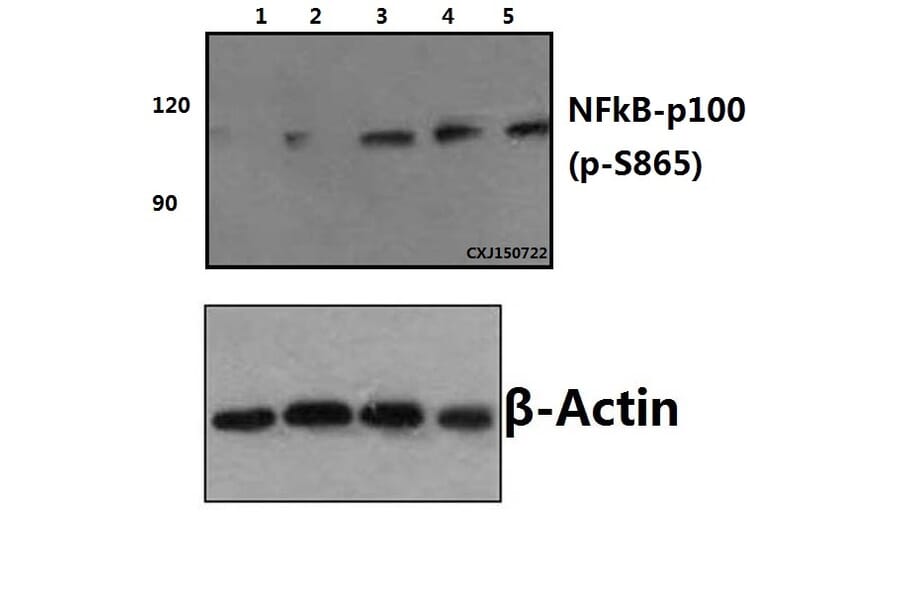 Anti-NFkB-p100 (phospho-S865) Antibody from Bioworld Technology (BS4129) - Antibodies.com