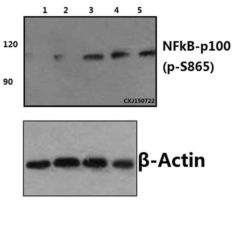 Anti-NFkB-p100 (phospho-S865) Antibody from Bioworld Technology (BS4129) - Antibodies.com