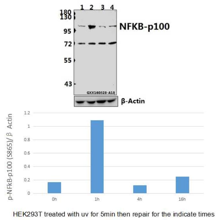 Anti-NFkB-p100 (phospho-S865) Antibody from Bioworld Technology (BS4129) - Antibodies.com