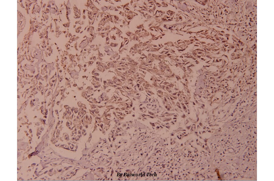 Anti-NFkB-p100 (phospho-S865) Antibody from Bioworld Technology (BS4129) - Antibodies.com