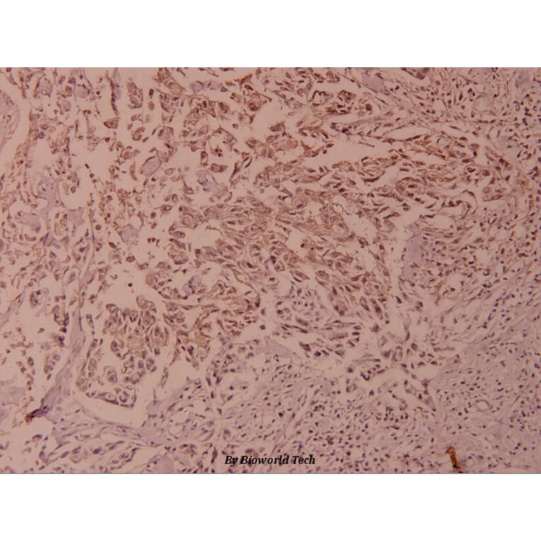 Anti-NFkB-p100 (phospho-S865) Antibody from Bioworld Technology (BS4129) - Antibodies.com