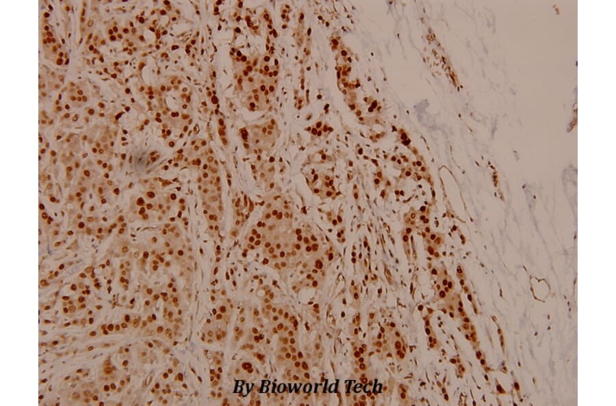 Anti-NFkB-p105/p50 (phospho-S337) Antibody from Bioworld Technology (BS4132) - Antibodies.com