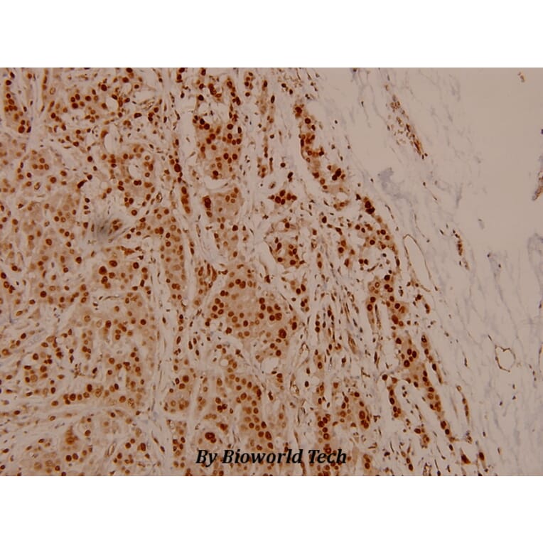 Anti-NFkB-p105/p50 (phospho-S337) Antibody from Bioworld Technology (BS4132) - Antibodies.com