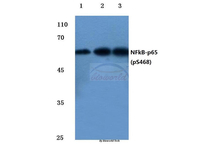 Anti-NFkB-p65 (phospho-S468) Antibody from Bioworld Technology (BS4136) - Antibodies.com