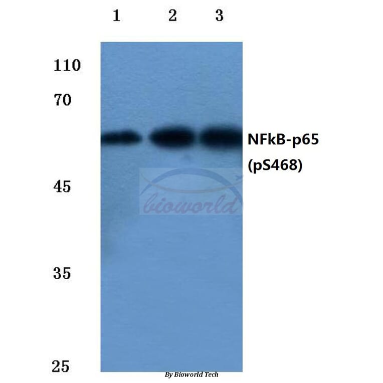 Anti-NFkB-p65 (phospho-S468) Antibody from Bioworld Technology (BS4136) - Antibodies.com